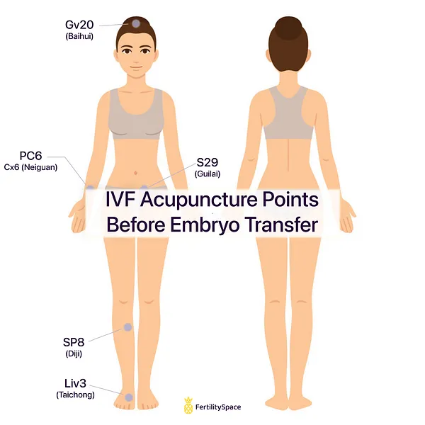 These were the fertility acupuncture point locations used before the embryo transfer in the Paulus et al. (2002) protocol.