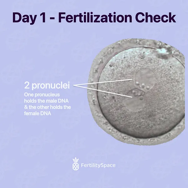 The day after IVF/ICSI, all eggs are checked for signs of fertilization. Successful fertilization is identified by the presence of 2 pronuclei. Zygote image: ESHRE Atlas of Human Embryology.