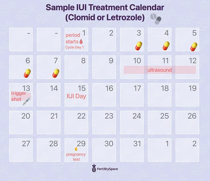 A typical treatment calendar for intrauterine insemination. This example calendar shows the basic timeline for Clomid IUI or Letrozole IUI. Dates may vary slightly depending on how you respond to the fertility medications. 